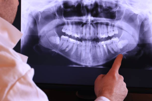 Best Emergency Dental Care for Trauma or Injury in Thermopolis, WY
