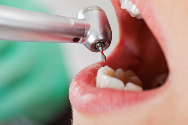 Best Pediatric Emergency Dentist in Thermopolis, WY